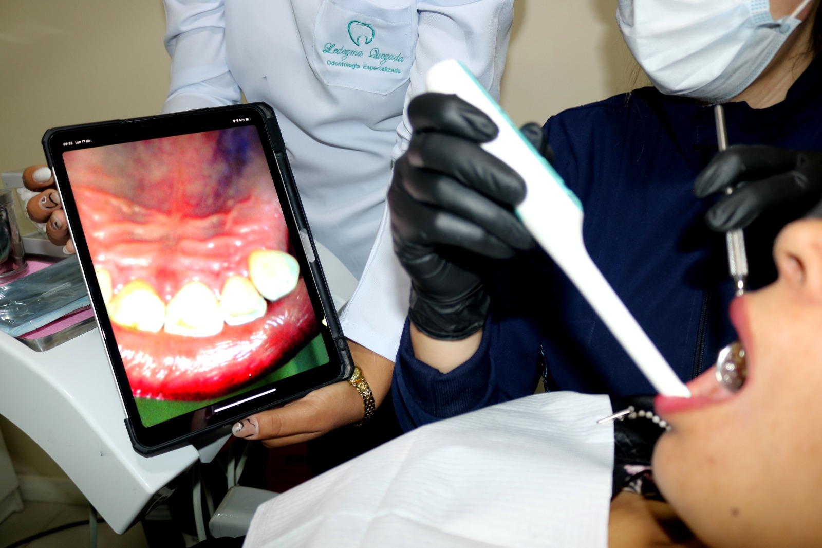 Periodoncia - Imagen 1